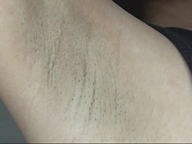 300人の腋 2　サンプル画像07